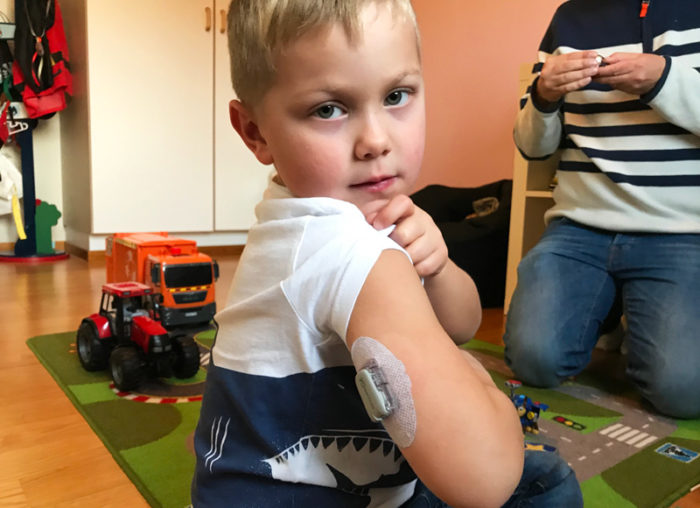Theo Stenlundh visar sin sensor på armen som mäter hans blodsockervärde. Diabetes typ 1, barn.